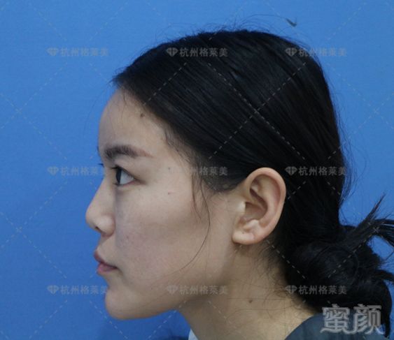 https://img.miyanlife.com/mnt/timg/180526/12061J422-4.jpg