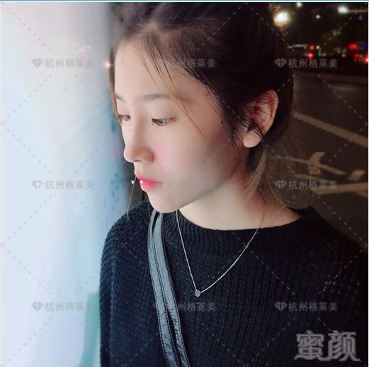 https://img.miyanlife.com/mnt/timg/180526/1206201015-15.jpg