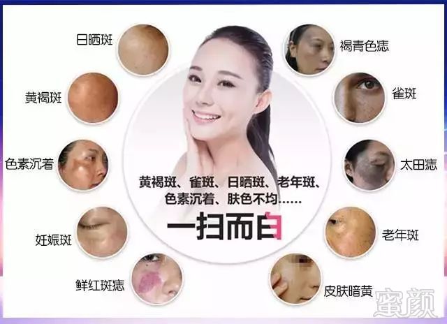 https://img.miyanlife.com/mnt/timg/180526/121515BO-4.jpg