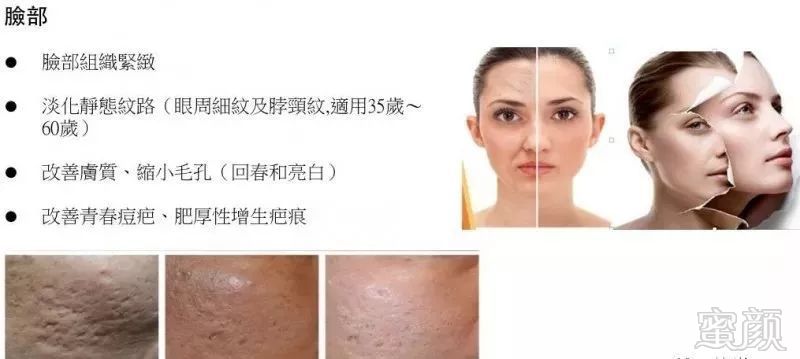 https://img.miyanlife.com/mnt/timg/180527/100H91O0-3.jpg