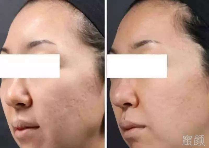 https://img.miyanlife.com/mnt/timg/180527/100I02348-10.jpg