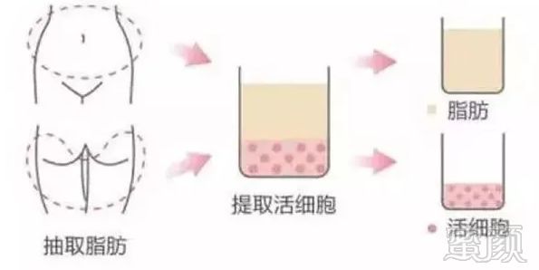 https://img.miyanlife.com/mnt/timg/180527/1054111N9-5.jpg