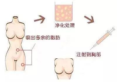 https://img.miyanlife.com/mnt/timg/180527/1054113336-4.jpg