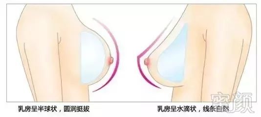https://img.miyanlife.com/mnt/timg/180527/105412C17-10.jpg