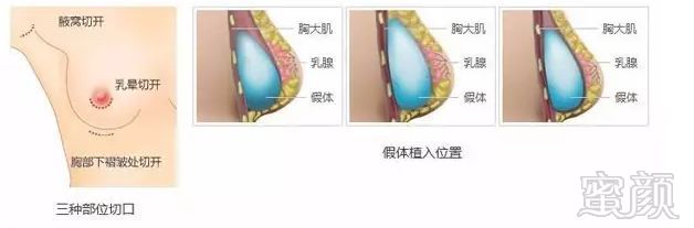 https://img.miyanlife.com/mnt/timg/180527/105412J41-9.jpg