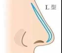 https://img.miyanlife.com/mnt/timg/180527/1152564024-4.jpg