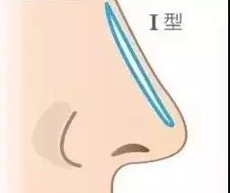 https://img.miyanlife.com/mnt/timg/180527/11525A5T-3.jpg