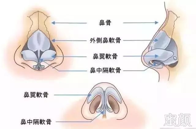 https://img.miyanlife.com/mnt/timg/180527/11525AT2-1.jpg