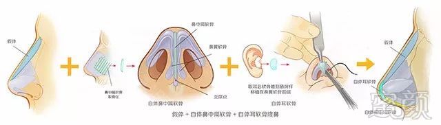 https://img.miyanlife.com/mnt/timg/180527/11525L018-7.jpg