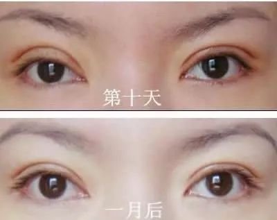 https://img.miyanlife.com/mnt/timg/180527/1209125401-7.jpg