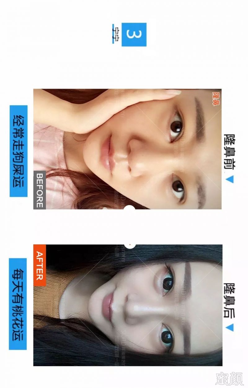https://img.miyanlife.com/mnt/timg/180527/121214K24-4.jpg