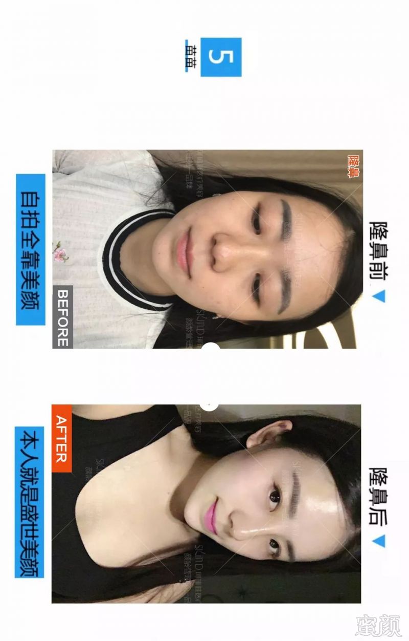 https://img.miyanlife.com/mnt/timg/180527/12121C949-6.jpg