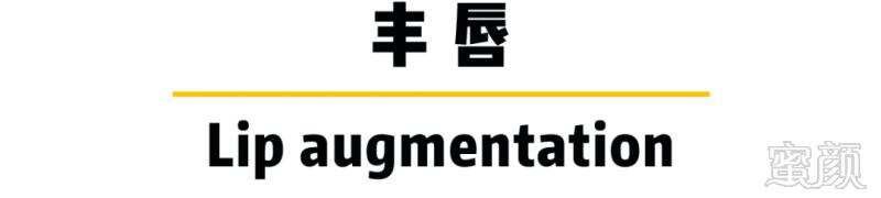 https://img.miyanlife.com/mnt/timg/180527/1224215611-8.jpg