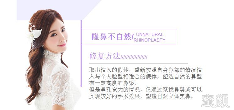 https://img.miyanlife.com/mnt/timg/180528/1216104519-6.jpg
