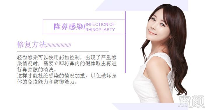 https://img.miyanlife.com/mnt/timg/180528/1216104L4-5.jpg