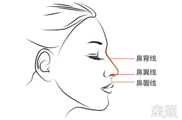 https://img.miyanlife.com/mnt/timg/180528/1216106135-2.jpg