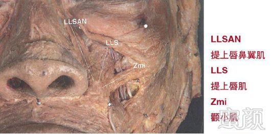 https://img.miyanlife.com/mnt/timg/180528/121FK3K-3.jpg