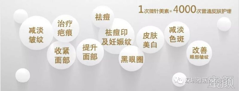 https://img.miyanlife.com/mnt/timg/180528/12431T516-4.jpg