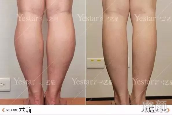 https://img.miyanlife.com/mnt/timg/180528/124941E20-4.jpg
