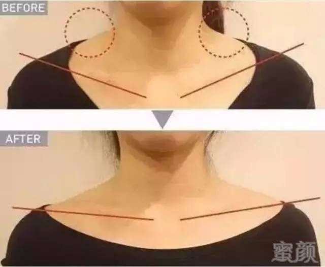 https://img.miyanlife.com/mnt/timg/180528/124941GI-5.jpg
