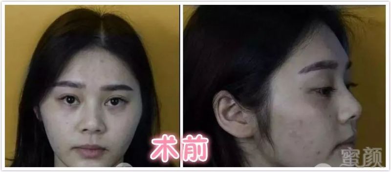 https://img.miyanlife.com/mnt/timg/180528/1255361919-0.jpg