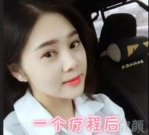 https://img.miyanlife.com/mnt/timg/180528/12553G313-3.jpg
