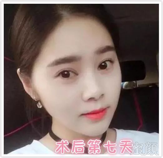 https://img.miyanlife.com/mnt/timg/180528/12553JQ8-2.jpg