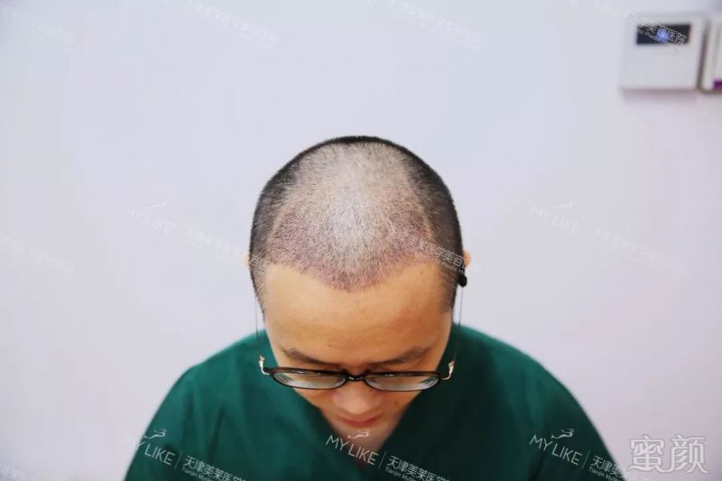 https://img.miyanlife.com/mnt/timg/180528/133Z43539-6.jpg