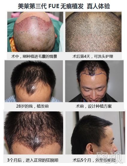 https://img.miyanlife.com/mnt/timg/180528/133Z55N5-10.jpg