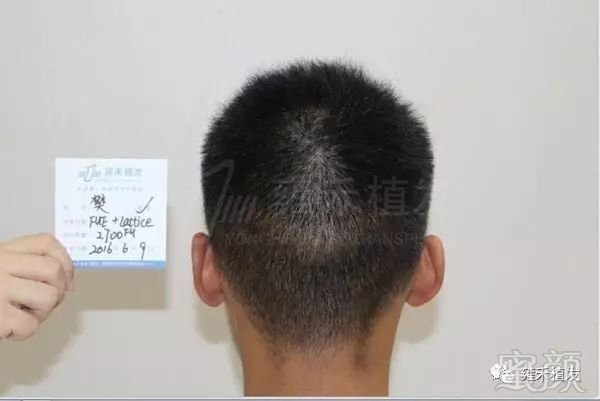 https://img.miyanlife.com/mnt/timg/180528/13400L142-2.jpg
