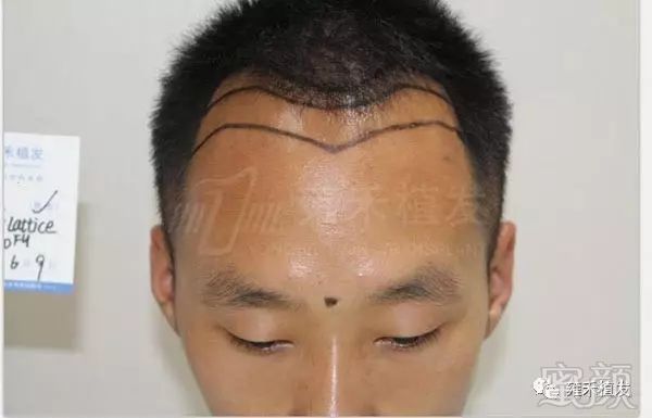 https://img.miyanlife.com/mnt/timg/180528/13400MQ3-1.jpg