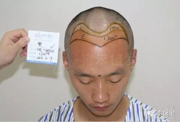 https://img.miyanlife.com/mnt/timg/180528/13400MS9-3.jpg
