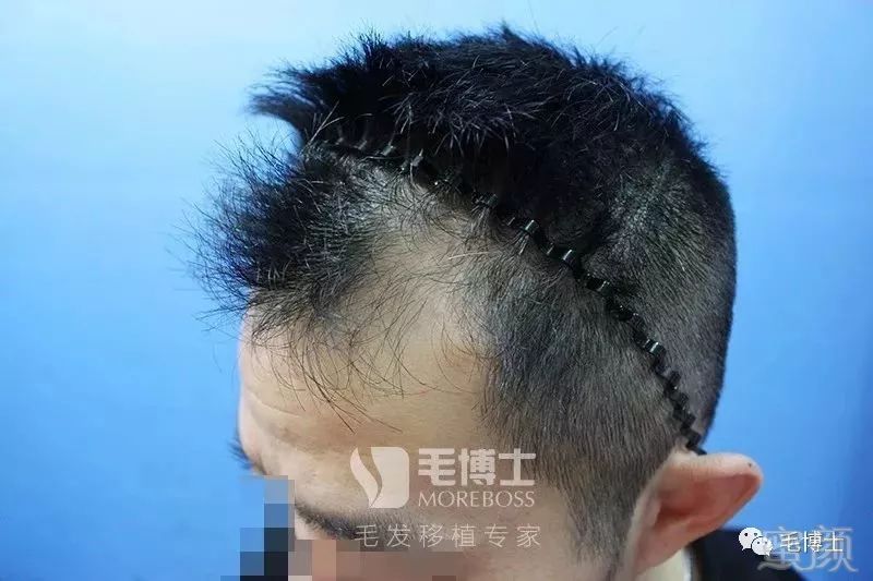 https://img.miyanlife.com/mnt/timg/180528/13413B2K-5.jpg