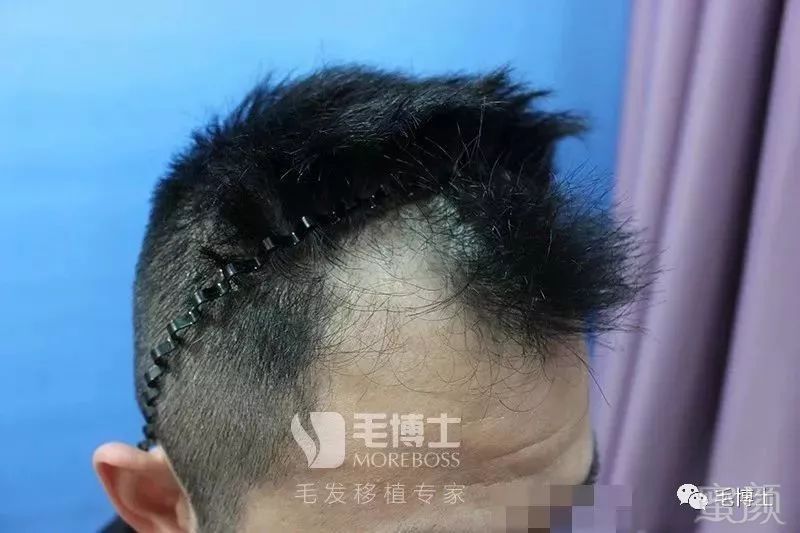 https://img.miyanlife.com/mnt/timg/180528/13413B358-6.jpg