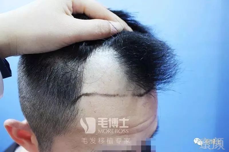 https://img.miyanlife.com/mnt/timg/180528/13413J120-10.jpg