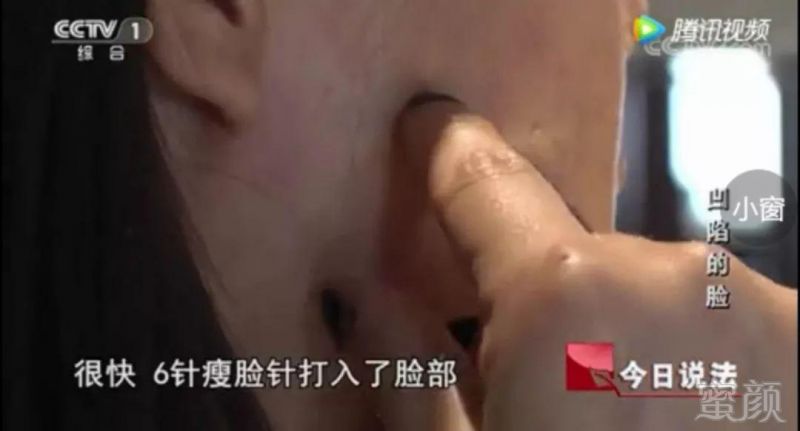 https://img.miyanlife.com/mnt/timg/180528/1F245MZ-0.jpg