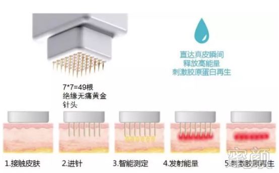 https://img.miyanlife.com/mnt/timg/180529/10052M1F-4.jpg