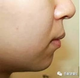 https://img.miyanlife.com/mnt/timg/180529/1016422364-6.jpg