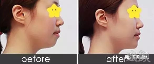 https://img.miyanlife.com/mnt/timg/180529/1016432T5-11.jpg