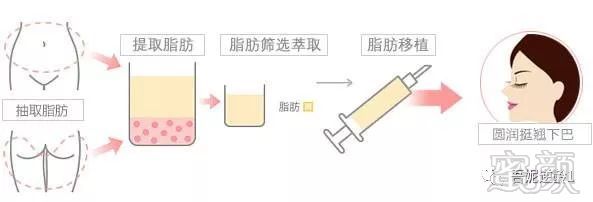 https://img.miyanlife.com/mnt/timg/180529/1016435262-12.jpg