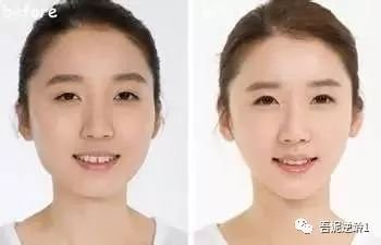 https://img.miyanlife.com/mnt/timg/180529/1016444H2-15.jpg