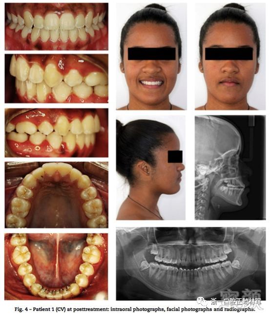 https://img.miyanlife.com/mnt/timg/180529/102F93356-5.jpg
