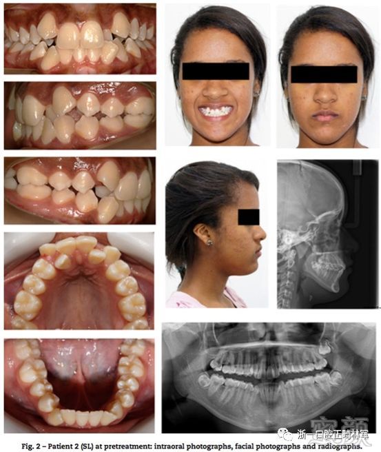 https://img.miyanlife.com/mnt/timg/180529/102FS150-2.jpg