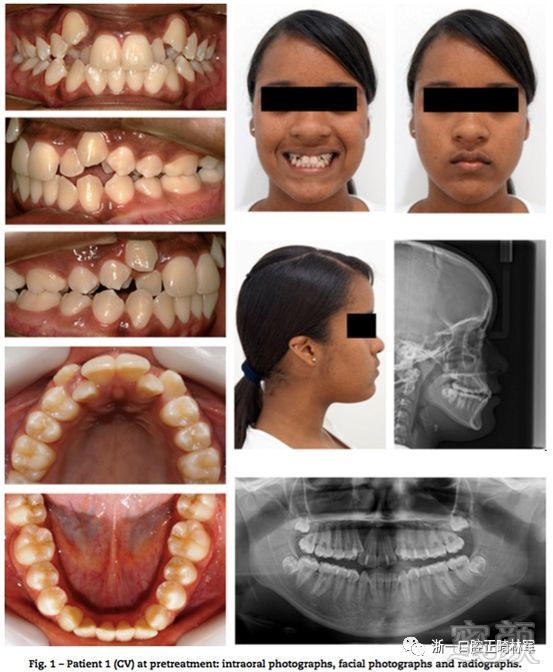 https://img.miyanlife.com/mnt/timg/180529/102FS927-1.jpg