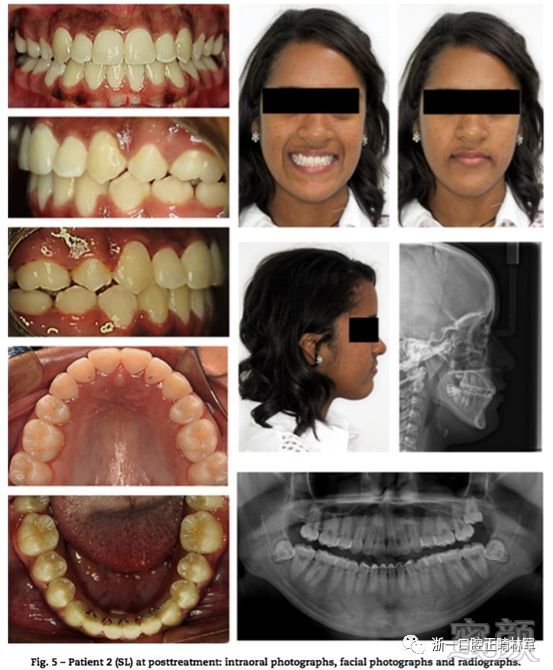 https://img.miyanlife.com/mnt/timg/180529/102G062F-6.jpg