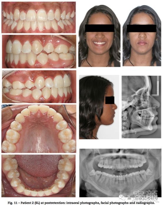 https://img.miyanlife.com/mnt/timg/180529/102G11448-12.jpg