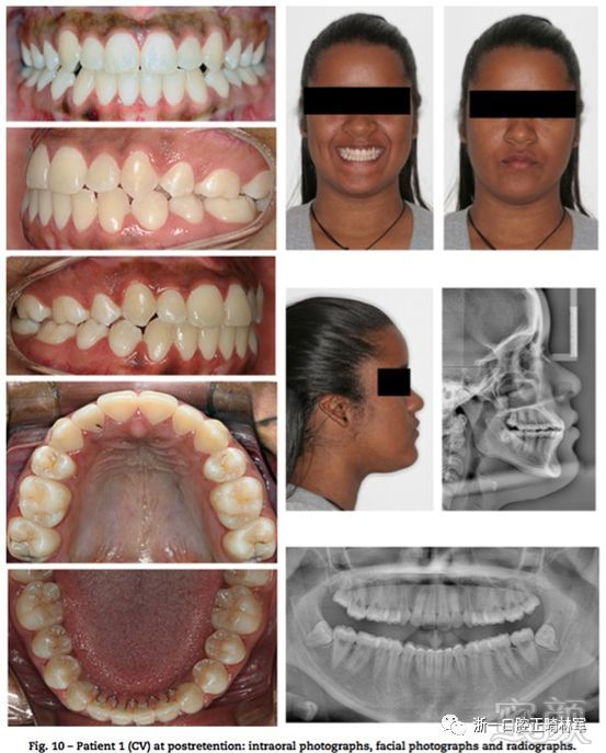 https://img.miyanlife.com/mnt/timg/180529/102G11626-11.jpg