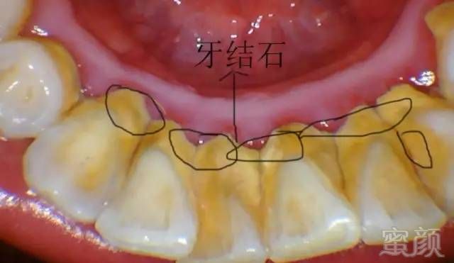 案例图片