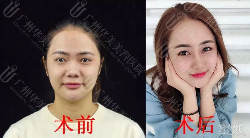https://img.miyanlife.com/mnt/timg/180529/103J345M-9.jpg