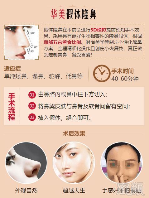 https://img.miyanlife.com/mnt/timg/180529/103J420Q-11.jpg